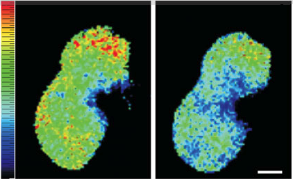 A pixel-by-pixel ratio of the 490 nm excitation image by the 430 nm excitation image from two cultured HEK293 cells expressing Perceval during control conditions (left) and after 40 min of metabolic inhibition with 5 mM 2-deoxyglucose (right)